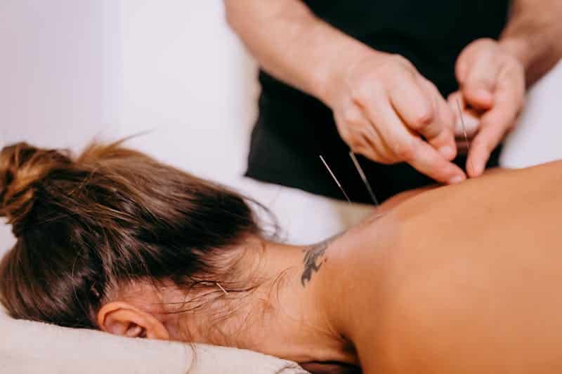 woman having acupuncture
